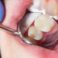 Advanced Dental Care & Orthodontics image 7